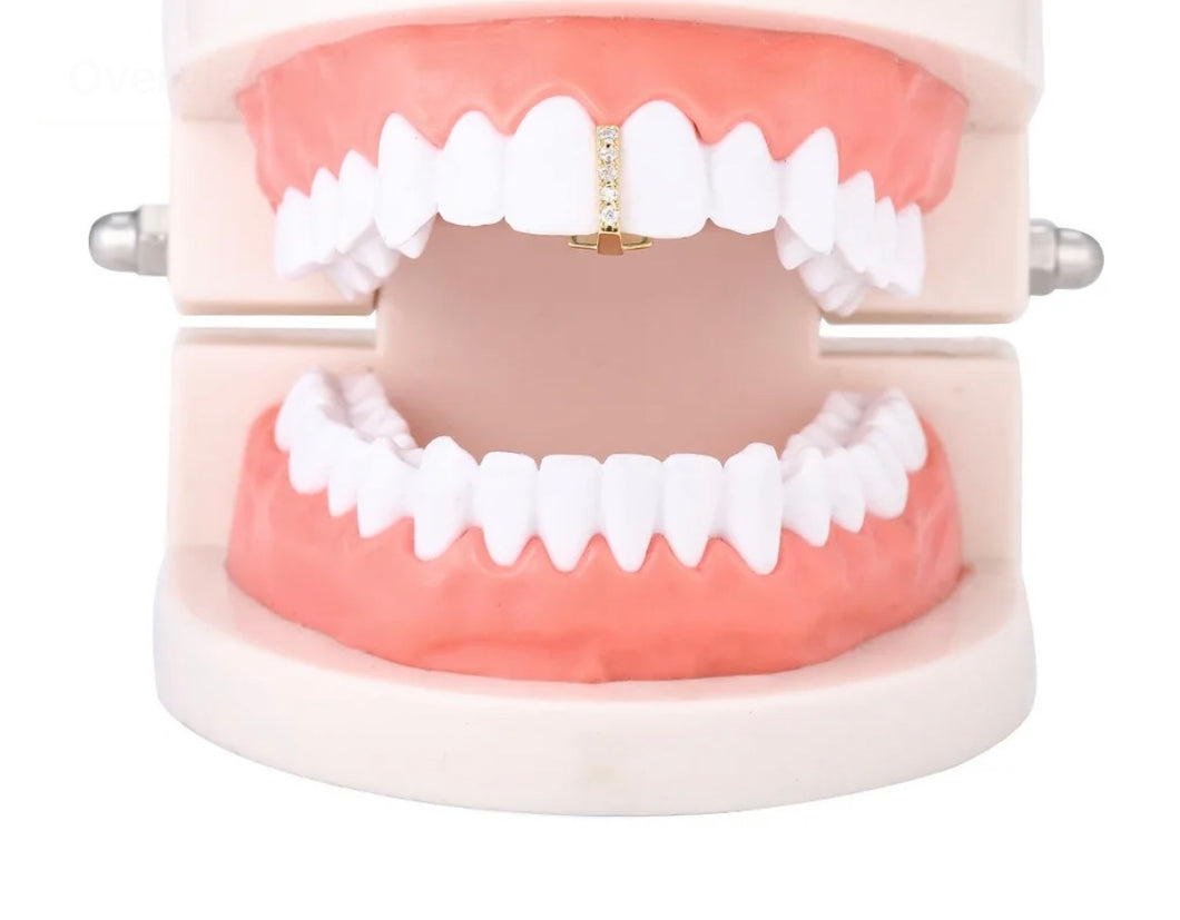 Bling Teeth Spacer